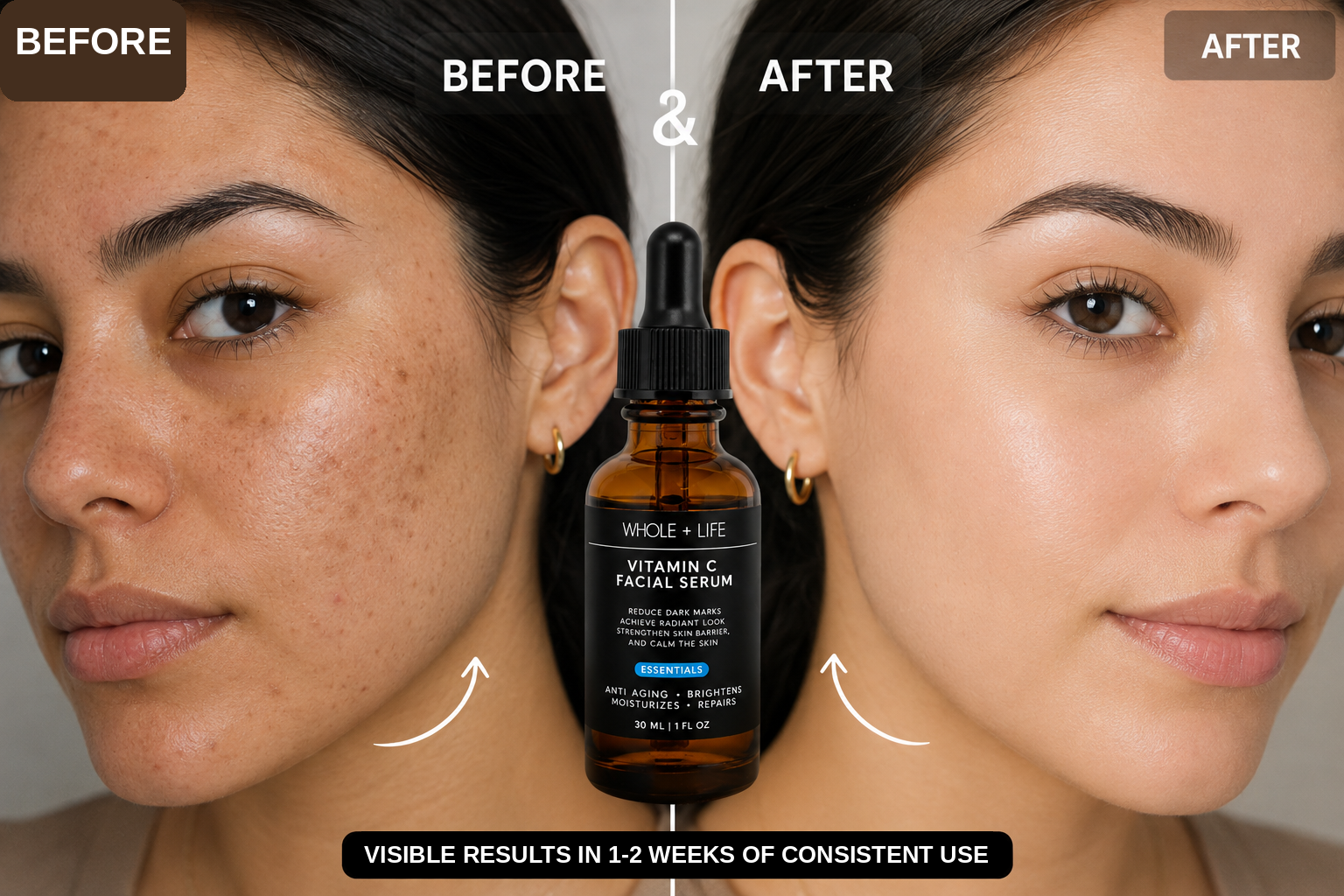 Before and after two weeks of consistent Lumora vitamin C serum use, second example