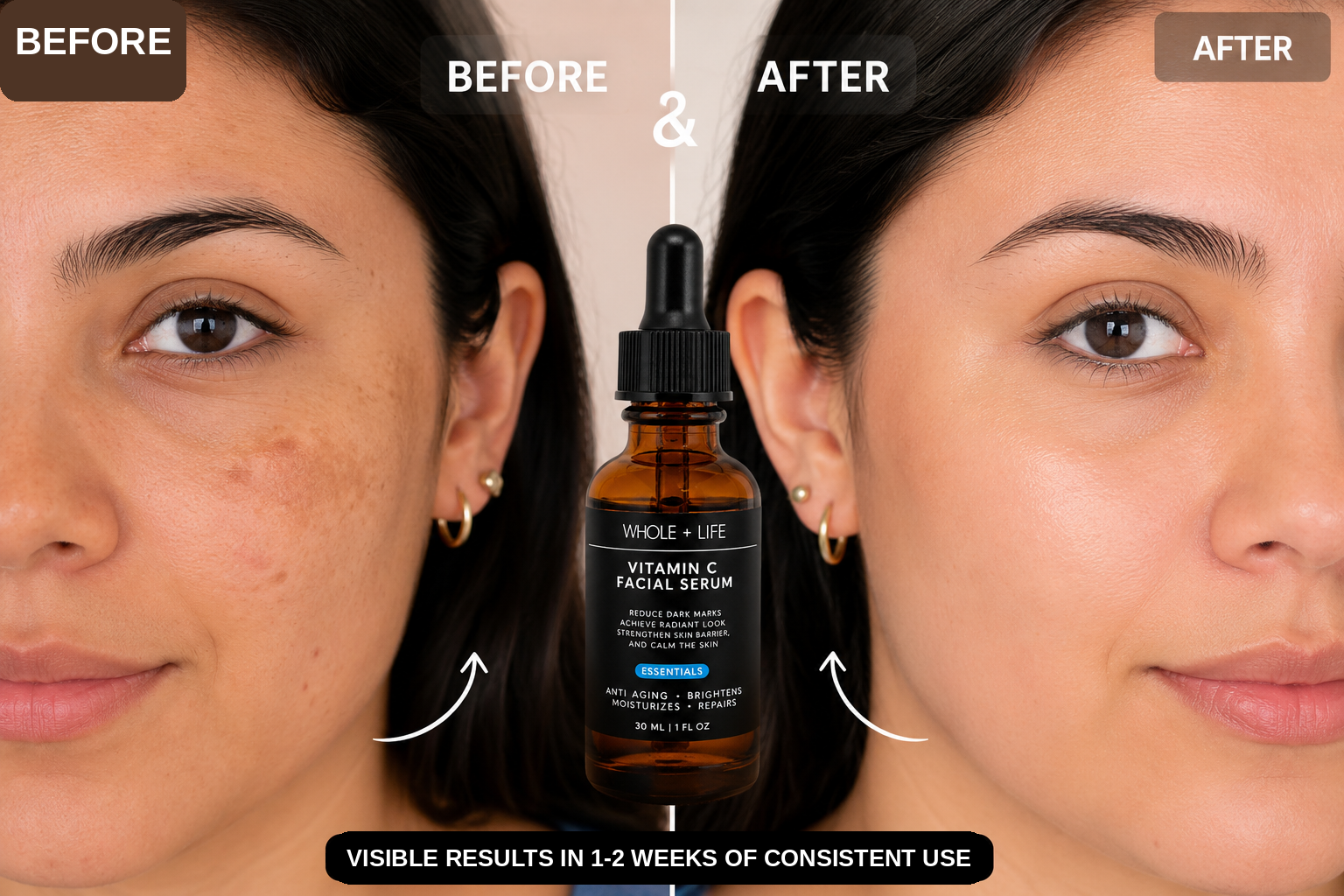 Before and after two weeks of consistent Lumora vitamin C serum use
